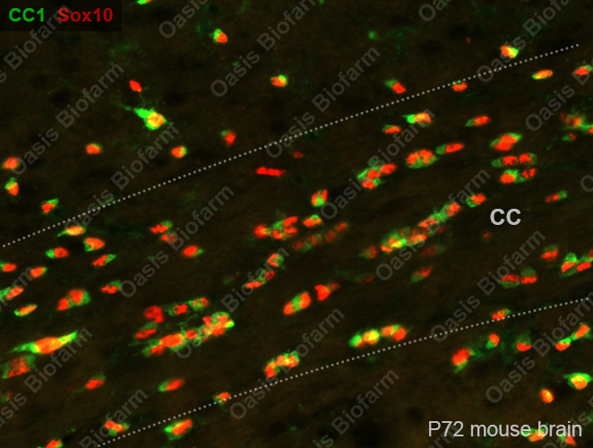 CC24 11哈里伯顿19分艾维23分活塞大胜步行者